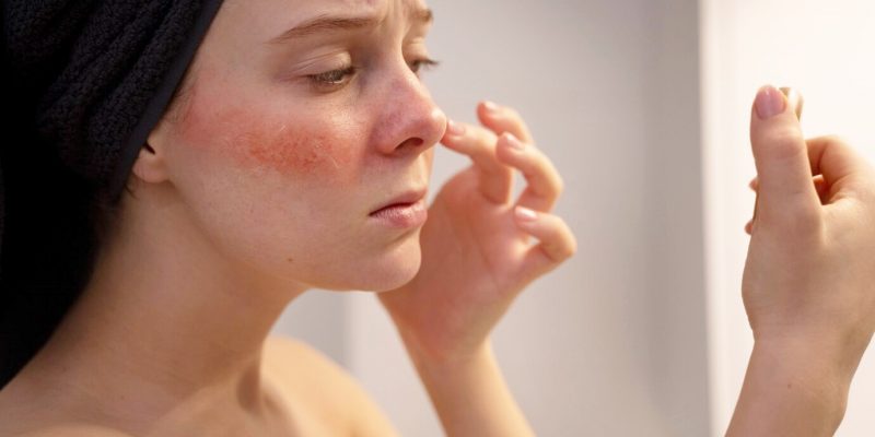 woman-looking-her-rosacea-mirror_23-2150248373